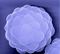 Graphical abstract: Synthetic strategies for raspberry-like polymer composite particles