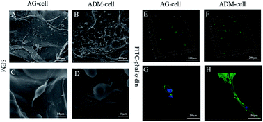 Graphical abstract: Three-dimensional cell printing of gingival fibroblast/acellular dermal matrix/gelatin–sodium alginate scaffolds and their biocompatibility evaluation in vitro