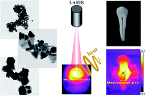 Graphical abstract: Efficient NIR energy conversion of plasmonic silver nanostructures fabricated with the laser-assisted synthetic approach for endodontic applications