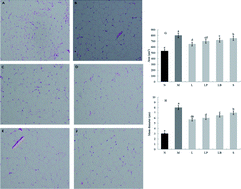 Graphical abstract: Effect of soybean milk fermented with Lactobacillus plantarum HFY01 isolated from yak yogurt on weight loss and lipid reduction in mice with obesity induced by a high-fat diet