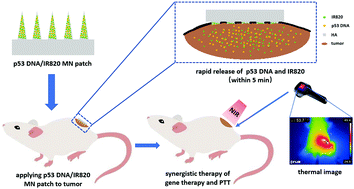 Graphical abstract: Rapidly dissolving microneedle patch for synergistic gene and photothermal therapy of subcutaneous tumor