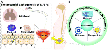Graphical abstract: Biomaterial-assisted drug delivery for interstitial cystitis/bladder pain syndrome treatment