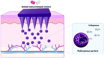 Graphical abstract: Design of biodegradable bi-compartmental microneedles for the stabilization and the controlled release of the labile molecule collagenase for skin healthcare