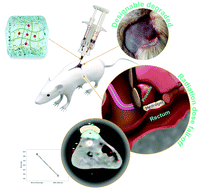 Graphical abstract: An injectable double-crosslinking iodinated composite hydrogel as a potential radioprotective spacer with durable imaging function