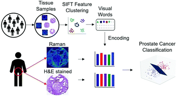 Graphical abstract: Feature fusion of Raman chemical imaging and digital histopathology using machine learning for prostate cancer detection