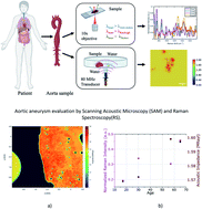 Graphical abstract: Aortic aneurysm evaluation by scanning acoustic microscopy and Raman spectroscopy