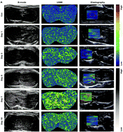 Graphical abstract: VEGFR2-targeted ultrasound molecular imaging of angiogenesis to evaluate liver allograft fibrosis
