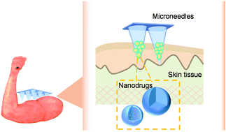 Graphical abstract: Microneedle-mediated transdermal nanodelivery systems: a review