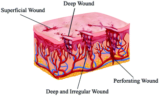 Graphical abstract: Recent advances in materials for hemostatic management