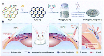 Graphical abstract: A graphene-Ag based near-infrared defined accurate anti-scarring strategy for ocular glaucoma surgery