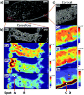 Graphical abstract: Quantification of local zinc and tungsten deposits in bone with LA-ICP-MS using novel hydroxyapatite–collagen calibration standards