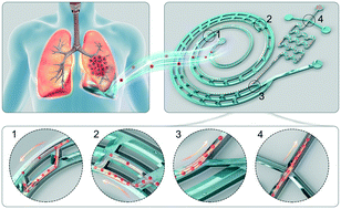 Graphical abstract: High-throughput concentration of rare malignant tumor cells from large-volume effusions by multistage inertial microfluidics