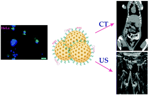 Graphical abstract: Mucin-16 targeted mesoporous nano-system for evaluation of cervical cancer via dual-modal computed tomography and ultrasonography