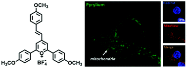 Graphical abstract: Fluorescent styrylpyrylium probes for the imaging of mitochondria in live cells