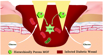 Graphical abstract: Hierarchically porous MOF-based microneedles for glucose-responsive infected diabetic wound treatment