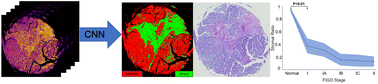 Graphical abstract: Leveraging mid-infrared spectroscopic imaging and deep learning for tissue subtype classification in ovarian cancer