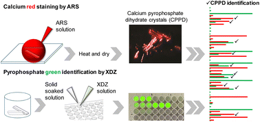 Graphical abstract: Fluorescence identification of arthropathic calcium pyrophosphate single crystals using alizarin red S and a xanthene dipicolylamine ZnII complex