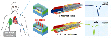 Graphical abstract: Stress induced self-rollable smart-stent-based U-health platform for in-stent restenosis monitoring