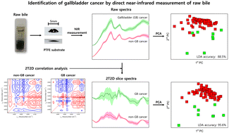Graphical abstract: Identification of gallbladder cancer by direct near-infrared measurement of raw bile combined with two-trace two-dimensional correlation analysis