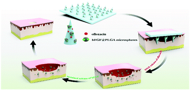 Graphical abstract: Dissolving microneedles with a biphasic release of antibacterial agent and growth factor to promote wound healing