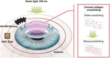 Graphical abstract: Smart contact lens containing hyaluronate–rose bengal conjugate for biophotonic myopia vision correction