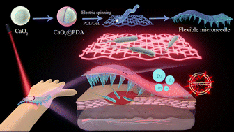 Graphical abstract: Rational design of flexible microneedles coupled with CaO2@PDA-loaded nanofiber films for skin wound healing on diabetic rats
