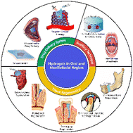 Graphical abstract: Hydrogels for the treatment of oral and maxillofacial diseases: current research, challenges, and future directions