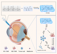 Graphical abstract: An injectable vitreous substitute with sustained release of metformin for enhanced uveal melanoma immunotherapy