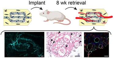 Graphical abstract: Perfusable cell-laden matrices to guide patterning of vascularization in vivo