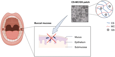 Graphical abstract: Mucoadhesive chitosan–methylcellulose oral patches for the treatment of local mouth bacterial infections