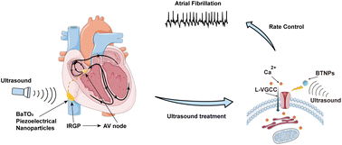 Graphical abstract: Ultrasound-mediated piezoelectric nanoparticle modulation of intrinsic cardiac autonomic nervous system for rate control in atrial fibrillation