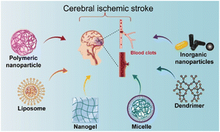Graphical abstract: Harnessing nanobiotechnology for cerebral ischemic stroke management