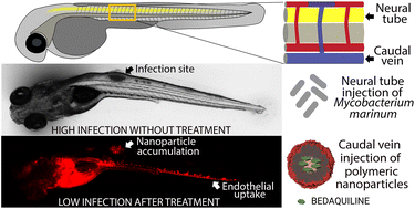 Graphical abstract: Subcellular localization and therapeutic efficacy of polymeric micellar nanoparticles encapsulating bedaquiline for tuberculosis treatment in zebrafish