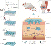 Graphical abstract: A mechanically tough and ultra-swellable microneedle for acute gout arthritis