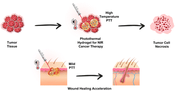 Graphical abstract: Metal-coordination synthesis of a natural injectable photoactive hydrogel with antibacterial and blood-aggregating functions for cancer thermotherapy and mild-heating wound repair
