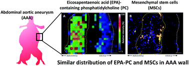 Graphical abstract: Eicosapentaenoic acid is associated with the attenuation of dysfunctions of mesenchymal stem cells in the abdominal aortic aneurysm wall