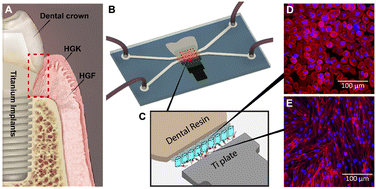 Graphical abstract: A dental implant-on-a-chip for 3D modeling of host–material–pathogen interactions and therapeutic testing platforms
