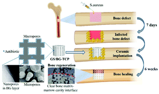 Graphical abstract: Construction of a drug-containing microenvironment for in situ bone regeneration