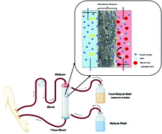 Graphical abstract: A biodegradable silver oxide-treated hydroxyapatite nanoparticle (AgO@HA)-interlaced poly(etherimide)/poly(methylmethacrylate) membrane for blood purification: an in vitro study