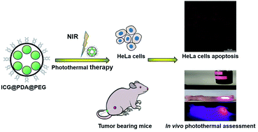 Graphical abstract: A highly efficient polydopamine encapsulated clinical ICG theranostic nanoplatform for enhanced photothermal therapy of cervical cancer