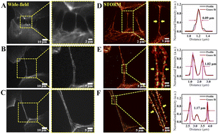 Graphical abstract: Revealing the structure and organization of intercellular tunneling nanotubes (TNTs) by STORM imaging