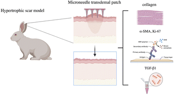 Graphical abstract: Comparison of the efficacy of seven types of microneedles for treating a rabbit hypertrophic scar model