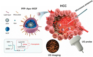 Graphical abstract: Perfluoropentane/apatinib-encapsulated metal–organic framework nanoparticles enhanced the microwave ablation of hepatocellular carcinoma
