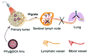 Graphical abstract: Doxorubicin-loaded polypyrrole nanovesicles for suppressing tumor metastasis through combining photothermotherapy and lymphatic system-targeted chemotherapy
