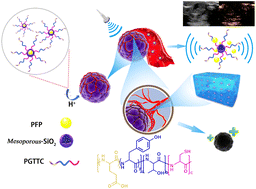 Graphical abstract: Mesoporous SiO2@pH-responsive polypeptide nanocomposites: noninterventional embolization and ultrasound imaging combination theranostic for solid tumors