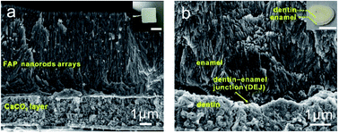 Graphical abstract: Room-temperature growth of fluorapatite/CaCO3 heterogeneous structured composites inspired by human tooth