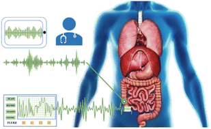 Graphical abstract: Graphene-based strain sensor with sandwich structure and its application in bowel sounds monitoring