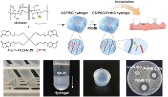 Graphical abstract: An antibacterial chitosan-based hydrogel as a potential degradable bio-scaffold for alveolar ridge preservation