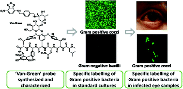Graphical abstract: Rapid detection of major Gram-positive pathogens in ocular specimens using a novel fluorescent vancomycin-based probe