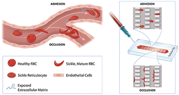 Graphical abstract: Microfluidic concurrent assessment of red blood cell adhesion and microcapillary occlusion: potential hemorheological biomarkers in sickle cell disease